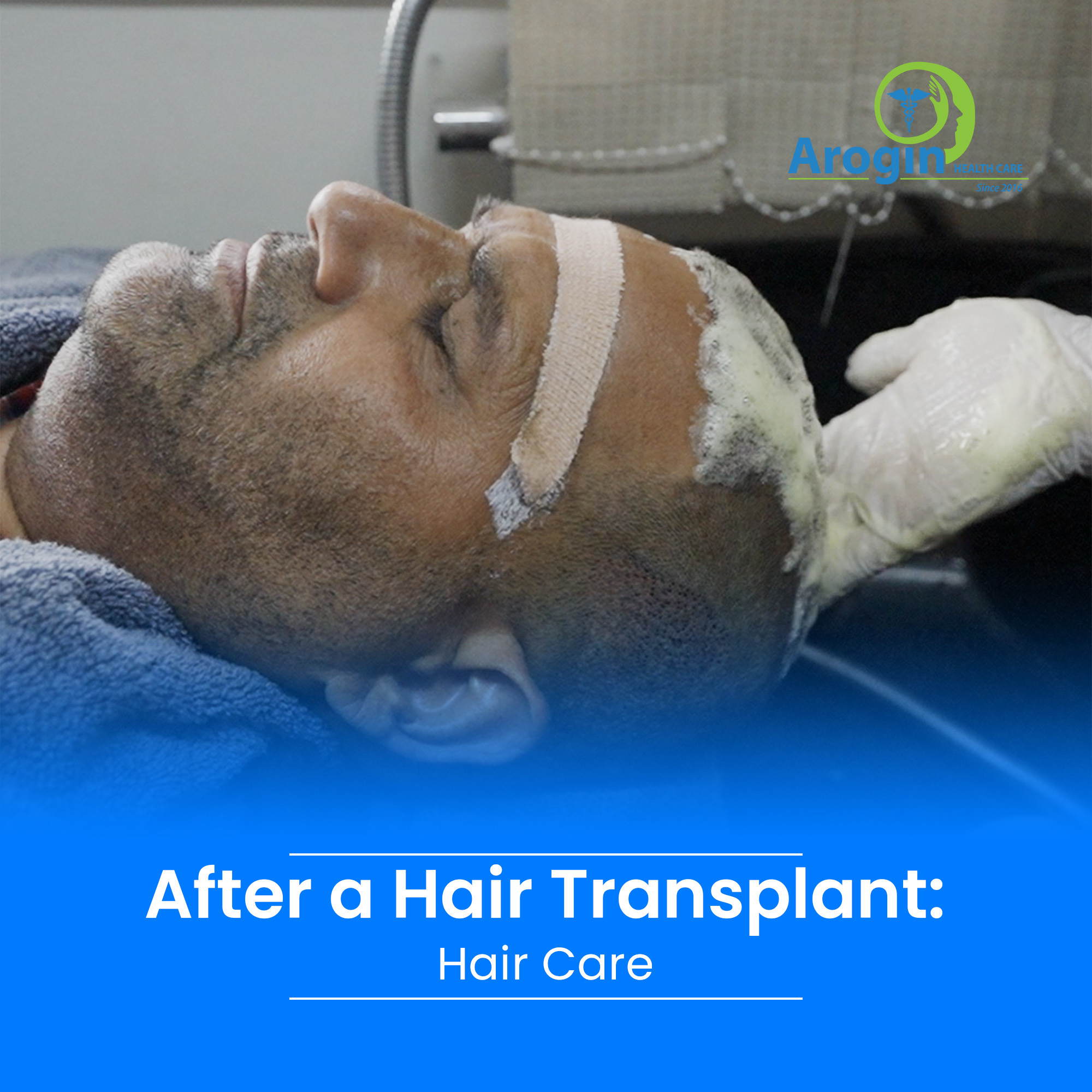 After a Hair Transplant: Hair Care